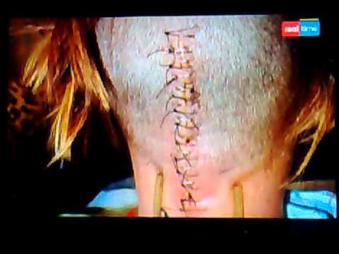 Lava per psoriasi di marca