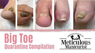 👣Big Toe Quarantine Compilation - How to Pedicure At Home👣