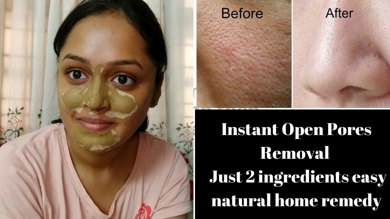 Instant Open Pores Removal Just 2 Ingredients Easy Natural Home