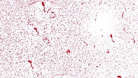 Cholera & Vibrio cholerae: Risks from Contaminated Environments, Food & Water - DayDayNews