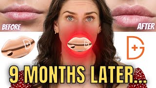 LED Plump Lips without Filler? Testing Dr. Dennis Gross LED Lip Spectralite Lipware PRO Details
