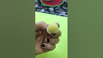 مسحه واحده لعلاج البواسير و للابد بمكونات طبيعيه 
