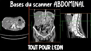 Les fondamentaux de l'imagerie abdominale | R2C / EDN / Médecine