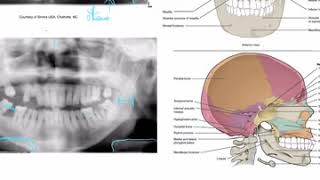 Famous Dental Assisting panoramic landmarks Profile