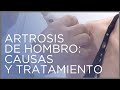 Artrosis de hombro: causas y tratamiento (por el Dr. Villamor en Saber Vivir)
