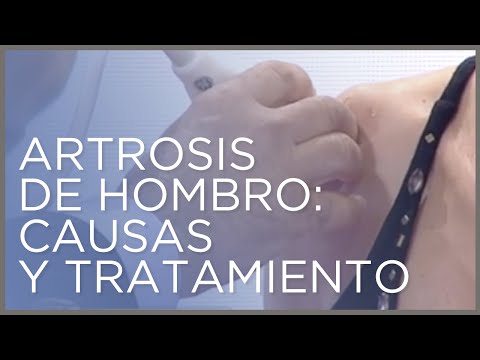 Vídeo: Osteoartritis De La Articulación Del Hombro: Síntomas, Tratamiento, Causas