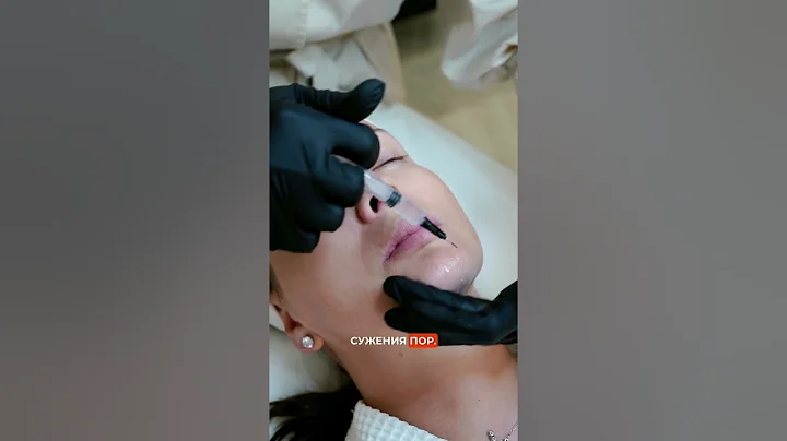 WIQO Uno by PRX-T33 | VV07Aesthetics Marbella  #vv07aesthetics #aestheticclinic #skincare