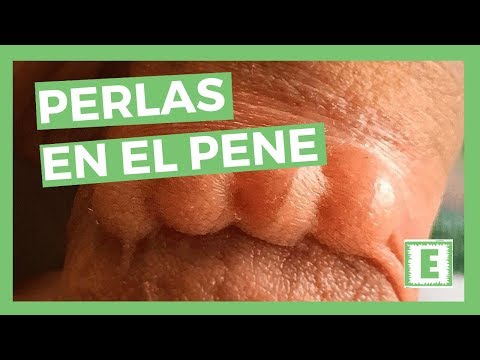 Como se hacen las perlas