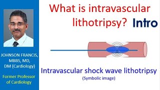 What is intravascular lithotripsy? Intro Net Worth