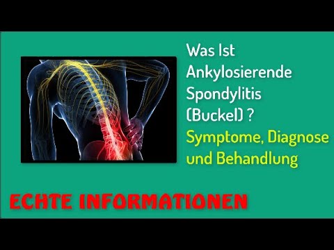 Was Ist Ankylosierende Spondylitis (Buckel) ? Symptome, Diagnose und Behandlung