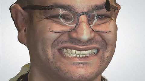 Face Scan Design – Digital Dentistry Workflow