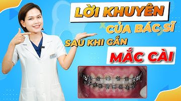 Niềng Răng Vinalign - Lời Khuyên Của Bác Sĩ Sau Khi Gắn Mắc Cài