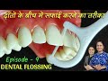 Floss kaise karte hain  dental flossing technique in hindi     episode  9