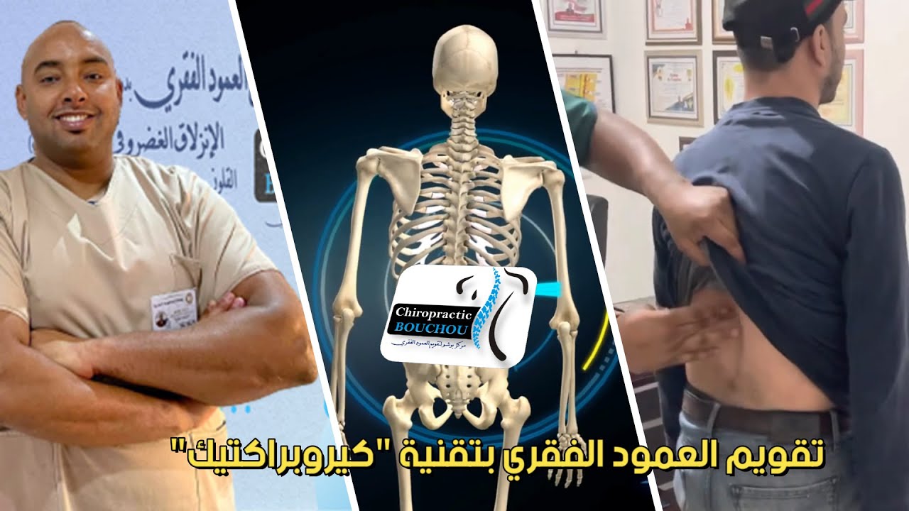 تقويم العمود الفقري بتقنية 