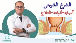 الشرخ الشرجى أسبابه,أنواعه,العلاج