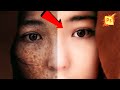 How to Beautify Photos With Photoshop in a New Way - Kivabe Sobir Dag Dur Korbo - Adobe Tech Bangla