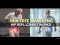 Hip Replacement Surgery | Pain-Free Walking Again | Manas Hospital Jaipur