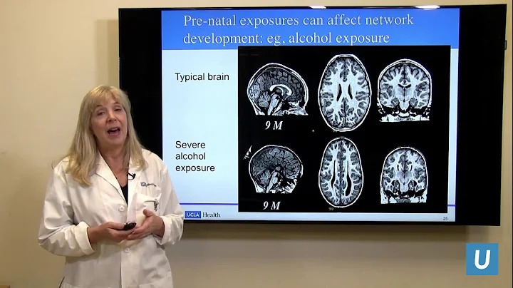 How Does a Child's Brain Develop? | Susan Y. Bookheimer PhD | UCLAMDChat - DayDayNews
