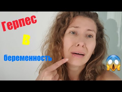 Опасный вирус|ГЕРПЕС в беременность|Как лечить герпес