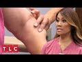 A Mother's Lipomas Might be Her Son's Future Too | Dr. Pimple Popper