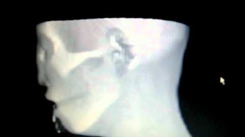 VTK Human Head Visualization 2