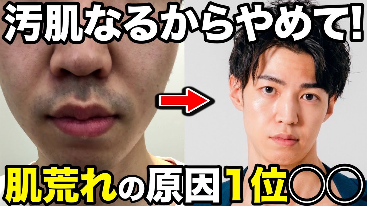 【スキンケア】気づいた時には既に遅い！肌荒れがどんどん進む悪習慣7選