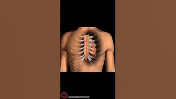 Hartbypassoperatie _ #cardiologie #kort