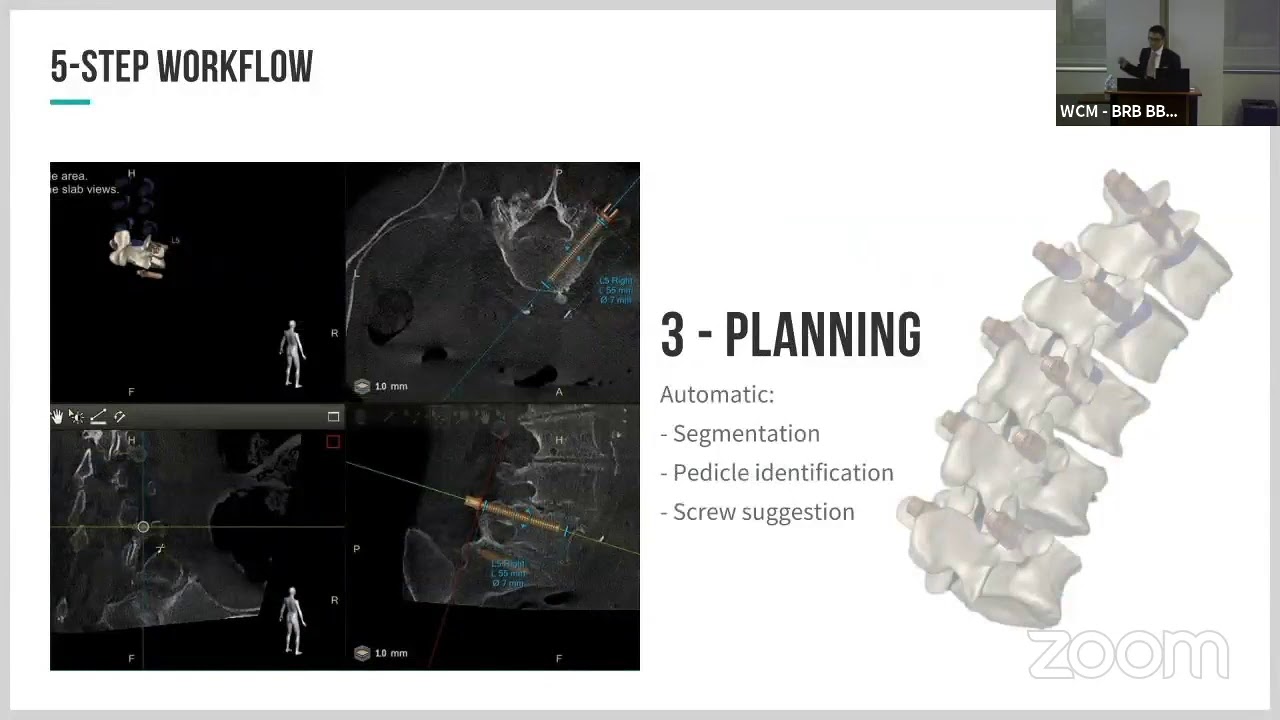 Augmented Reality Spinal Navigation   Adrian Elmi Terander