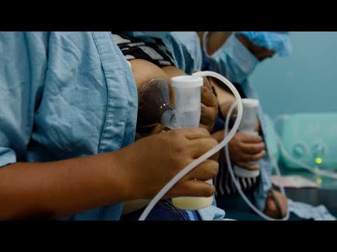 Vídeo: Donar Leche Materna: ¿es Seguro? ¿Y, Cómo Funciona?