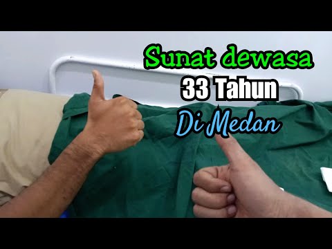 Sunat Dewasa / bang rangga 33 tahun / metode Laser