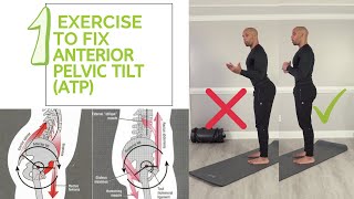 1 Exercise to Fix Anterior Pelvic Tilt (APT)