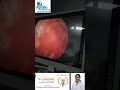 complete resolution of complicated uti with medication #femaleurologist #doctor #viral #reels #uti