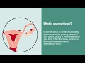 Endometriosis: Causes, Symptoms, Diagnosis, and Treatment | Merck Manual Consumer Version