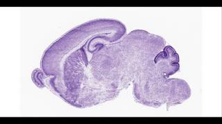mouse brain - P4 sagittal
