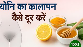 यन क कलपन कस दर कर? Yoni Ko Gora Kaise Karen Yoni Ka Kalapan Kaise Dur Karen Yoni