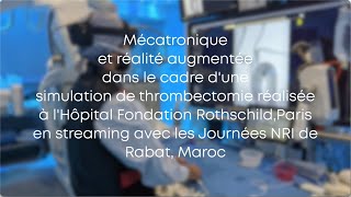 Simulation De Thrombectomie En Réalité Mixte Du Guide Actif Gecko35 En Streaming Francemaroc