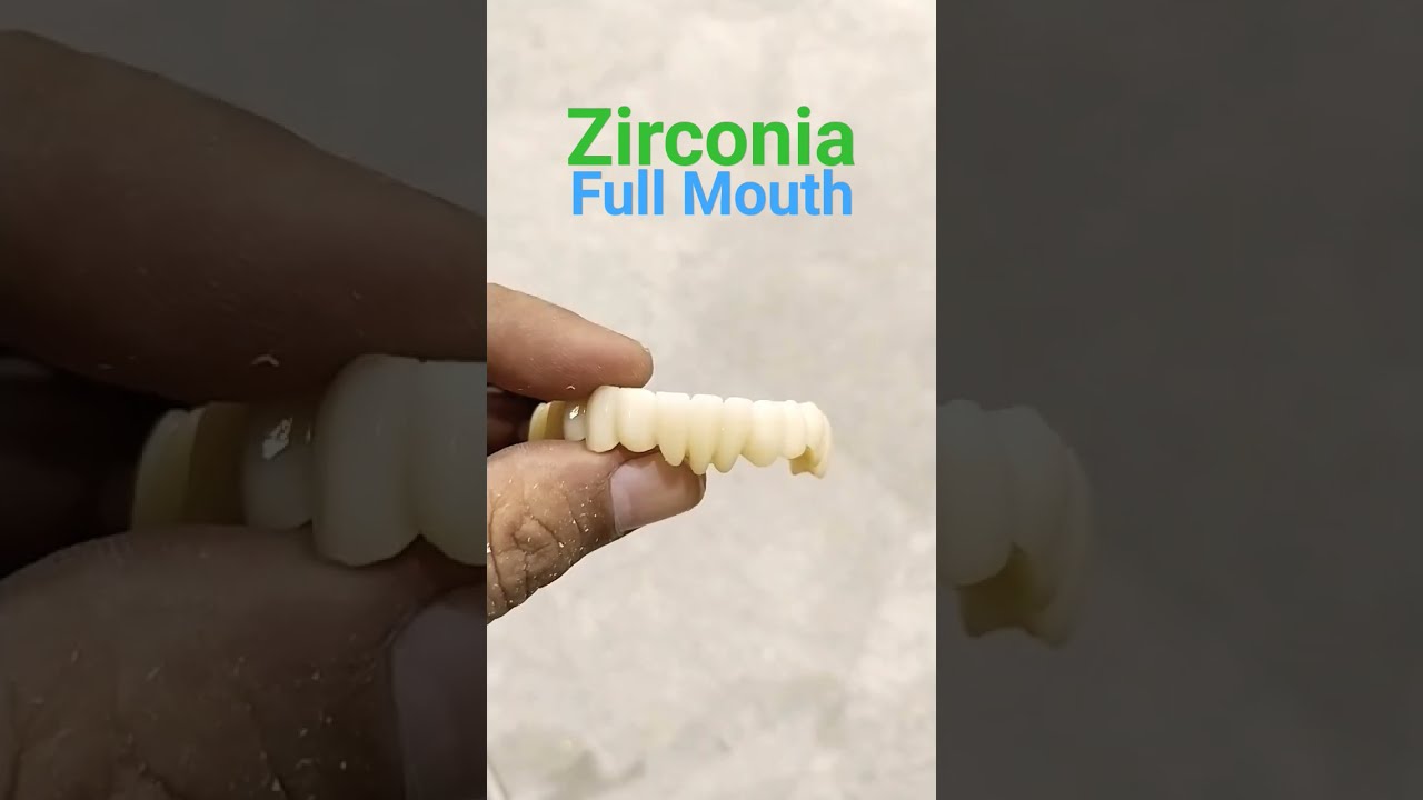Zirconia Full Mouth Bridge Dentalartbyhaider Dentures Dentist Dentistry Rpd