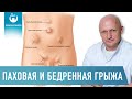 ПАХОВАЯ ГРЫЖА и БЕДРЕННАЯ ГРЫЖА. Причины, симптомы, диагностика, лечение, реабилитация Хирург Щевцов