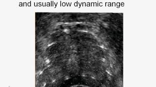 OFH, Actuality brachytherapy visualization methods