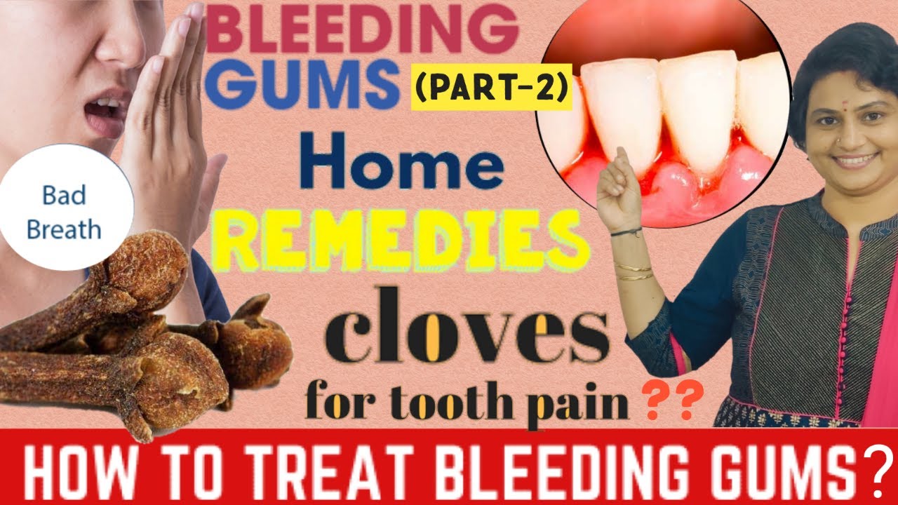 GUM DISEASE PART2TREATMENT & HOME REMEDIES/DENTAL CARE/TAMIL/DR.VIDYA
