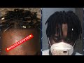 1 YEAR HIGHTOP / DROPFADE LOC JOURNEY‼️ CRAZY GROWTH‼️