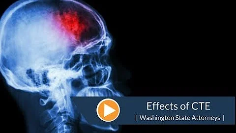 What Is CTE? - Chronic Brain Injury in the Eyes of the Law