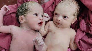 Twin female babies immediately after birth ,, one is already fed up of her sister cry