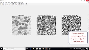 Matlab code for Identification of blood vessels using segmentation algorithm