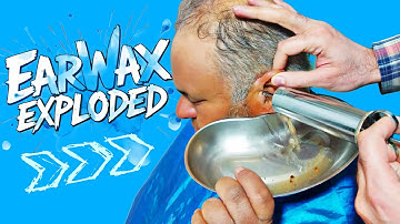 Ear Wax Exploded | Best Ear wax Removal #earwaxremoval #earwaxremoving #earwaxcleaning