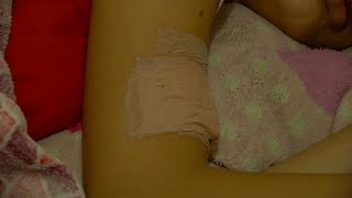 Mujer Obligaba A Niñas A Sentarse En Piedras Calientes - Teleantioquia Noticias