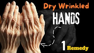 1 Absolute Best Remedy for Dry and Wrinkled Hands
