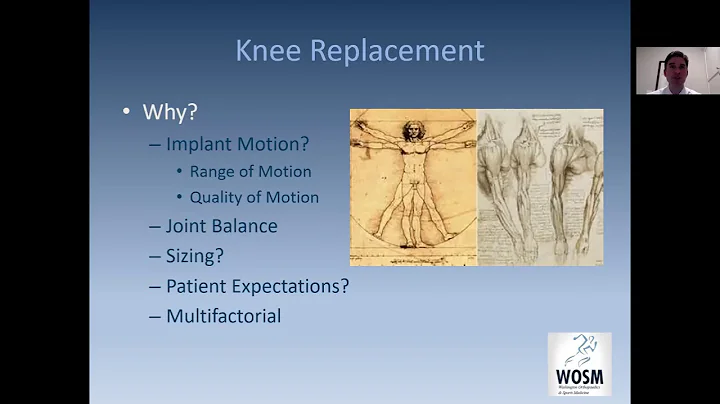 What's New in Hip and Knee Arthroplasty - J. Stuar...