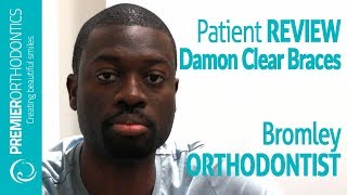 Damon Clear Braces Review Bromley Kent Premier Orthodontics