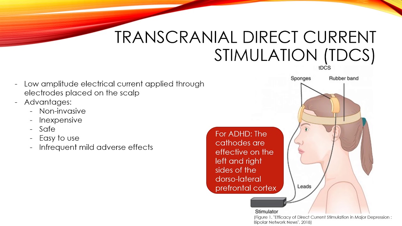 The Effect of tDCS on ADHD YouTube
